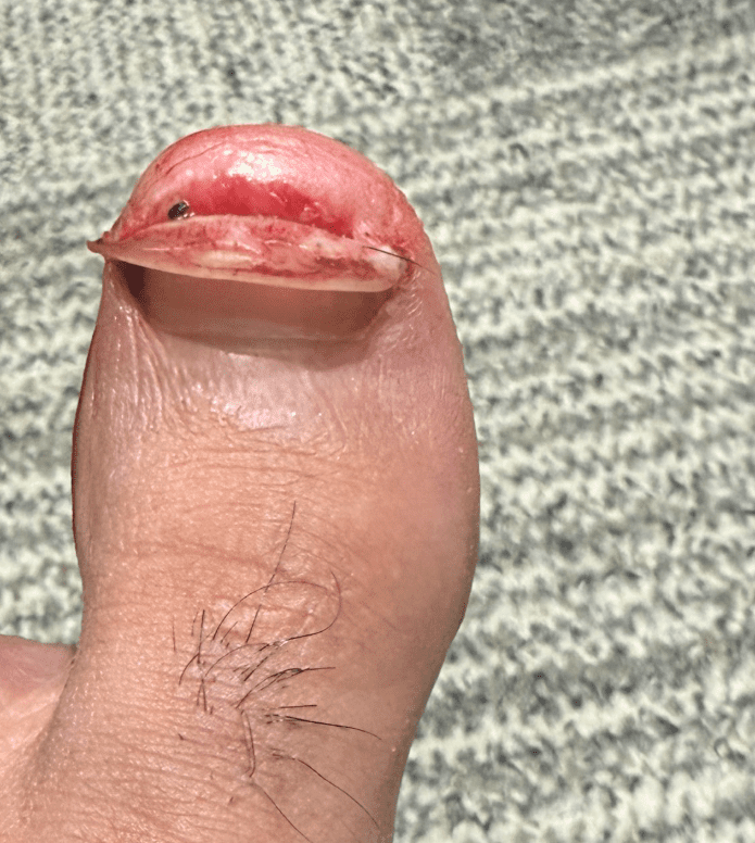 Mustafa Ali Shows Off Bloody Toe Injury After TNA Genesis