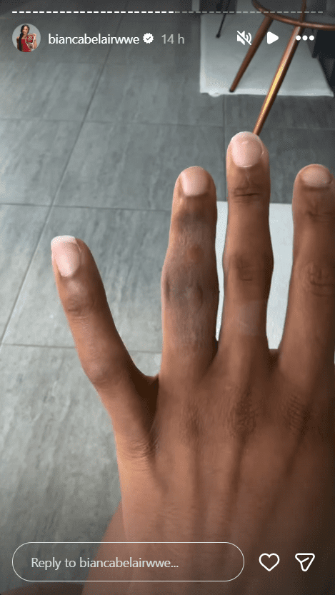 Positive Update on Bianca Belair's Recovery After Brutal WrestleMania Injury