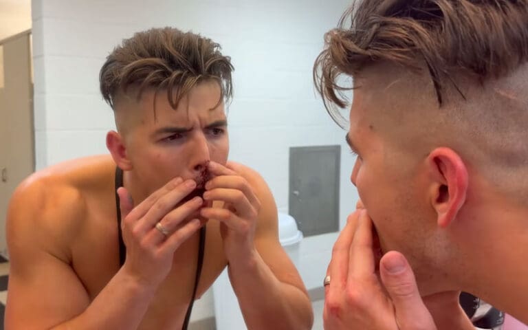 Sammy Guevara Reveals Possible Broken Nose After Bloody AEW Dynamite Match