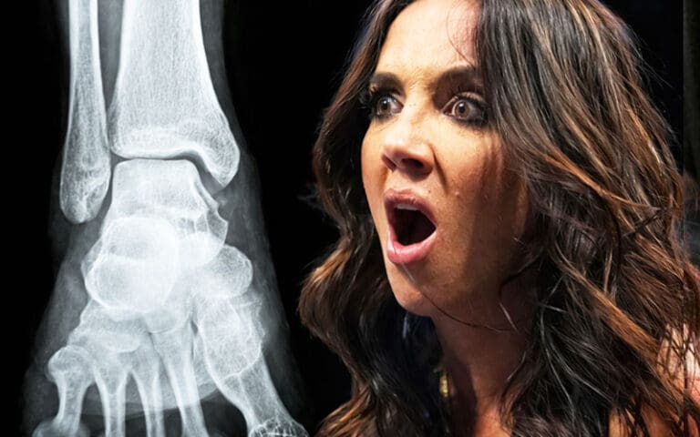 Chelsea Green’s Ankle Injury Far More Serious Than Expected