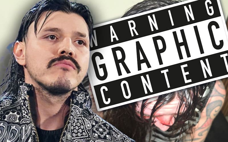 Dominik Mysterio Shows Off Bloody Head Injury After AAA Rey de Reyes 2026