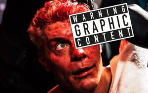 Cody Rhodes Drops Gruesome Behind-the-Scenes Photos of Eye Injury After WrestleMania 42