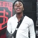 IShowSpeed Sporting Sling and Bruised Face After LA Knight Attack