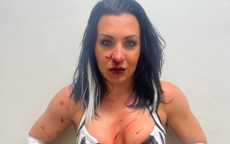 Lady Frost Might Have Broken Her Nose
