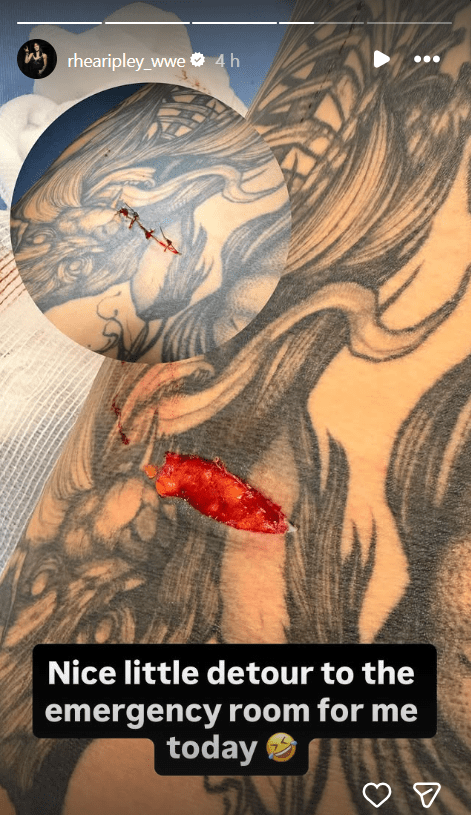Rhea Ripley Reveals Nasty Cut That Landed Her In Hospital After WWE RAW
