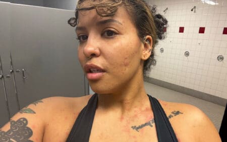 Willow Nightingale Reveals Severe Allergic Reaction After AEW Revolution