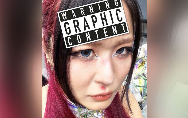 IYO SKY Shows Off Nasty Forehead Bruise After Liv Morgan’s Attack on WWE RAW