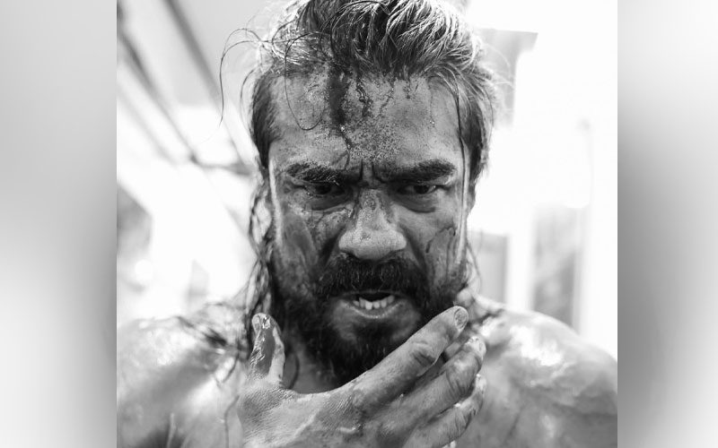 Andrade’s AEW Return Timeline Revealed After Bloody Injury