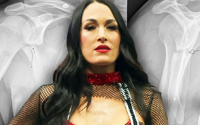 Brie Bella Reveals She Won’t Need Surgery After SummerSlam Injury